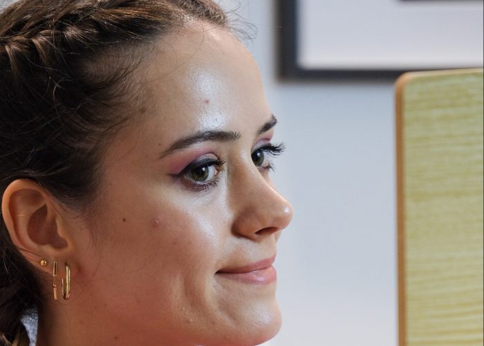 Edema After Rhinoplasty: The Final Step İnto a Good Result