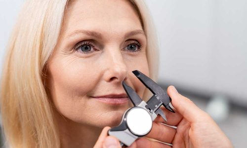 Revision Rhinoplasty: Frequently Asked Questions and Answers