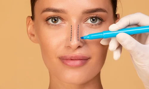 Ultrasonik Rinoplasti Nedir?