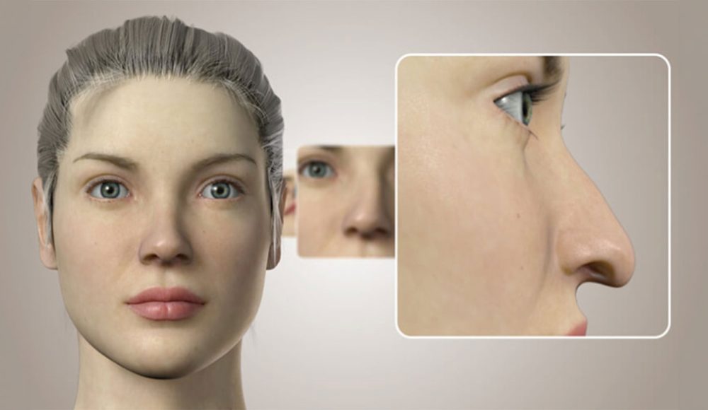3D Burun Simülasyonu ile Hayalinizdeki Burun Görünümüne Kavuşun 