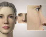 3D Burun Simülasyonu ile Rinoplasti Planlaması Nasıl Yapılır?