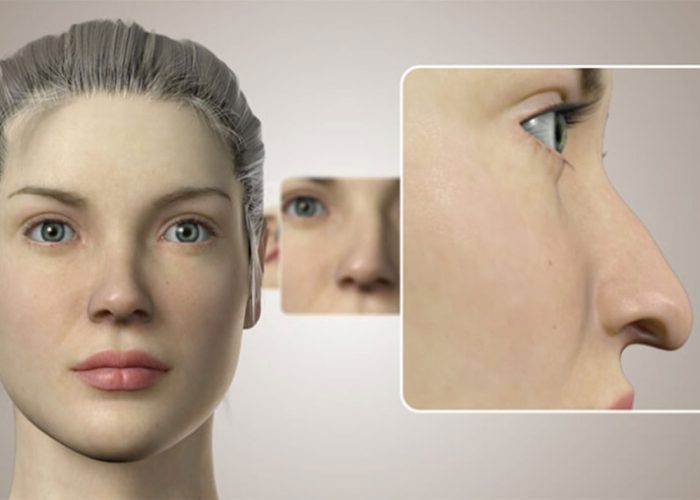 3D Burun Simülasyonu ile Hayalinizdeki Burun Görünümüne Kavuşun