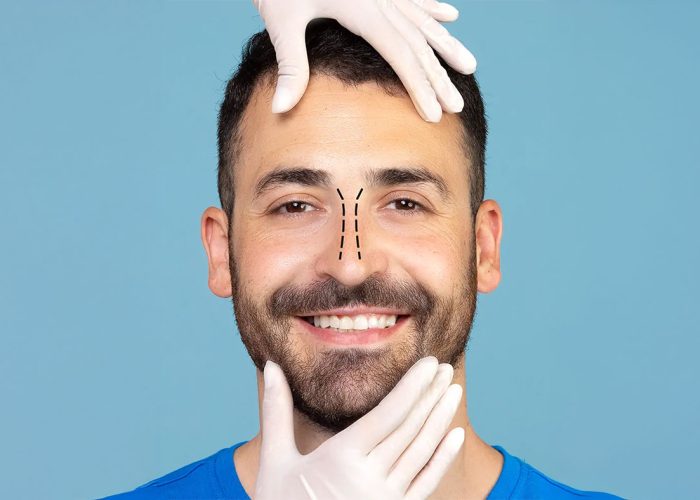 Revizyon Rinoplastide Doktor Seçimi: İkinci Şansınızı Kimlere Emanet Etmelisiniz?