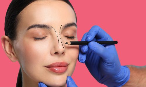 Is Revision Rhinoplasty Risky? What Should You Consider?